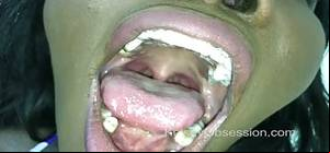 Mouth Fetish Porn - Mouth Fetish - Osa Lovely's Braces Mouth Tour